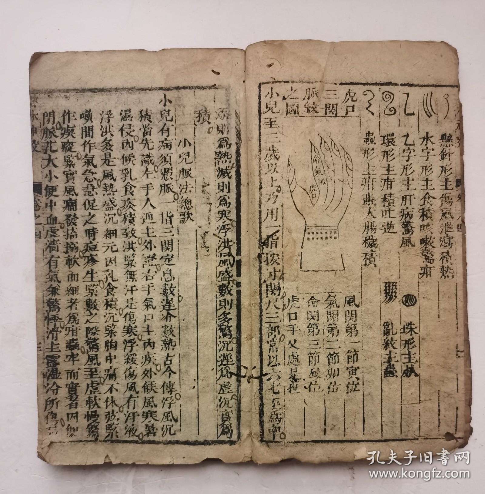 明代医书《新锲雲林神彀》卷四（末卷幼儿科），一部综合性医书。该书共四卷。明·龚廷贤撰。刊于明代万历十九年（辛卯1591年），内容包括临床各科病证证治。多编成歌诀，论述较简略。但选方颇多，包括一部分内府秘方。该卷四是幼儿科病症治疗部分，很多太醫院内府秘方，有精美刻像、刻图，非常珍贵！罕见木刻版本！