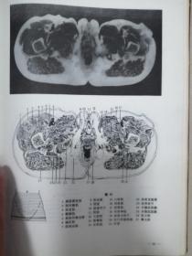 人体断面解剖学图谱