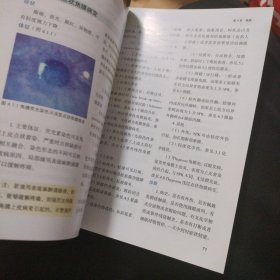 wills眼科手册（第7版）