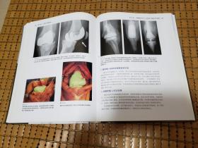 骨科标准手术技术丛书：膝关节置换术（第3版）