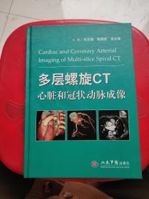 多层螺旋CT心脏和冠状动脉成像（签赠本）