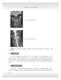 积水潭放射读片——骨肿瘤之中轴骨篇