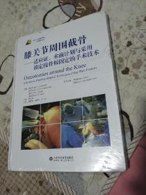 膝关节周围截骨--适应症 术前计划于采用 锁定接骨板固定 的手术技术