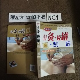 针灸拔罐刮痧