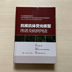 抗核抗体荧光核型图谱及病例判读