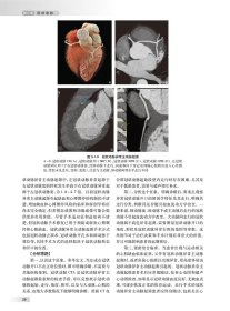 中华影像鉴别诊断学——心血管分册