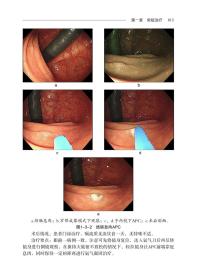 新华正版 消化内镜治疗学典型病例图谱 陈磊 柏健鹰 刘爱民 丁震 9787518980208 科学技术文献出版社 2021-09-01