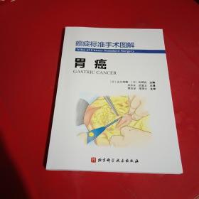 癌症标准手术图解——胃癌