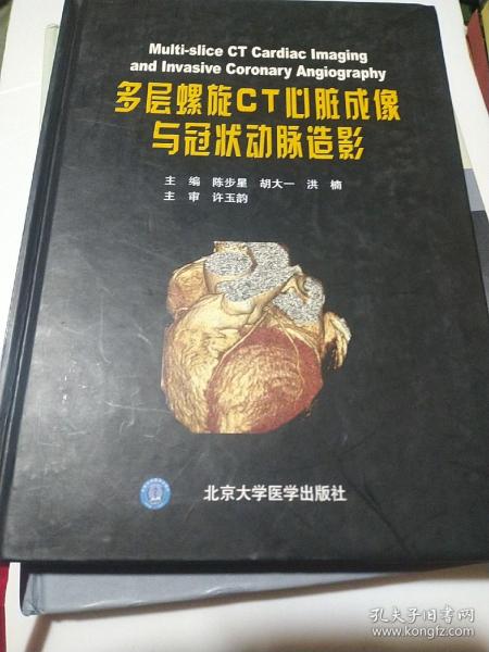 多层螺旋CT心脏成像与冠状动脉造影