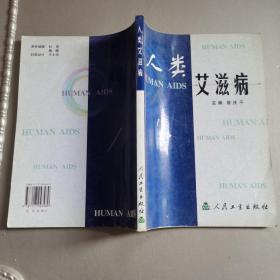 人类艾滋病