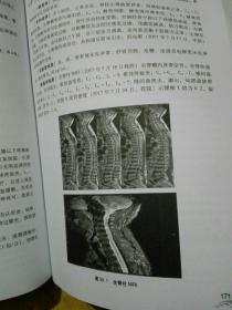 骨内科临床病例荟萃