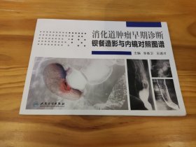 消化道肿瘤早期诊断：钡餐造影与内镜对照图谱