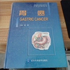 中国常见癌症丛书：胃癌
