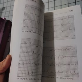 急诊医生心电图手册1
