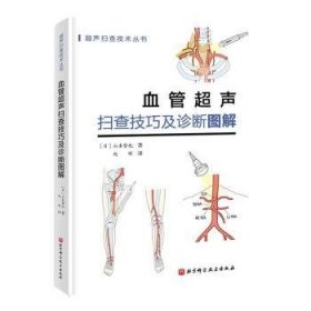 血管超声扫查技巧及诊断图解/超声扫查技术丛书