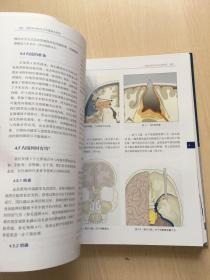 神经外科锁孔手术原则与应用