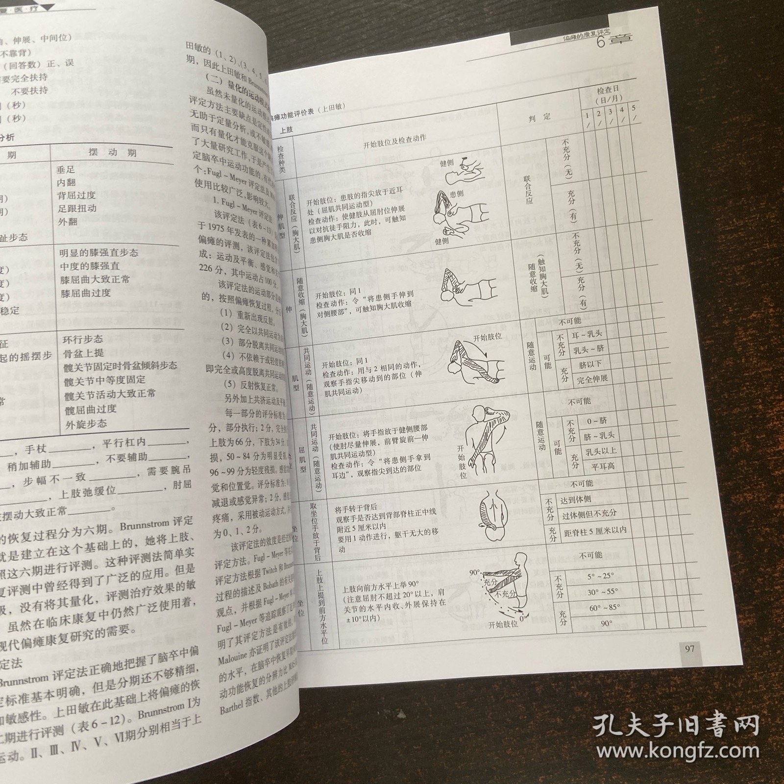 脑卒中的康复医疗