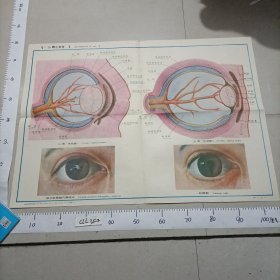 人体组织学胚胎学彩色挂图胚胎学中国医科大学XI一 39眼之发生 二