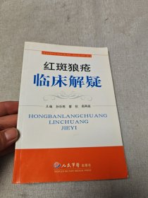 红斑狼疮临床解疑