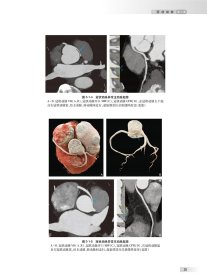 中华影像鉴别诊断学——心血管分册