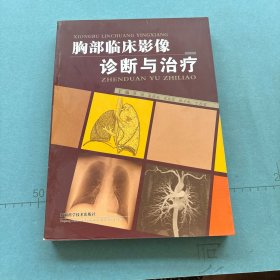 胸部临床影像诊断与治疗