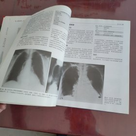胸部影像学（第2版）【1116】下端少许水渍印不影响阅读