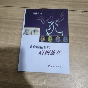 重症脑血管病病例荟萃