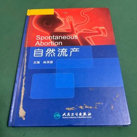 自然流产（精）