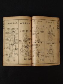民国六年【洞天奥旨 外科秘錄 附载经络图】全套四册，内容完整无缺。为清代名医陈士铎的外科专著。全书分十六卷，诸症九卷，又有奇方三卷。其对外科疮疡，辩证精当，用法神妙，处方大多屡试屡验，为外科上乘之作！