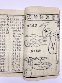 清早期木刻张世贤注《图注脉诀》共计四卷两册一套全。不避“玄”。半页九行二十字。中医文献。很难得的版本。