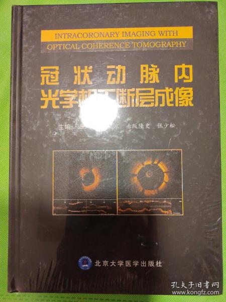 冠状动脉内光学相干断层成像