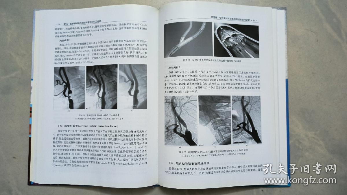 航天·医学领域钛合金材料基础研究及应用