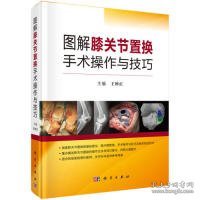 新华正版 图解膝关节置换手术操作与技巧 王坤正 9787030616418 科学出版社