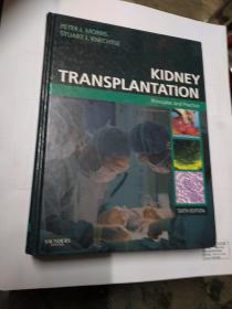 Kidney Transplantation肾脏移植: 原理与实践(大16开精装)