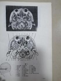 人体断面解剖学图谱