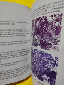 临床病理活检解读系列·子宫颈及子宫内膜活检病理解读（翻译版）