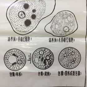 印刷品-医学教学图谱挂图（塑料）——11-1 溶组织内阿米巴【27】折痕、破损