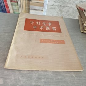 计划生育手术图解