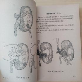 泌尿外科手术图解  泌尿外科手册