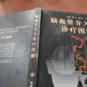 脑血管介入诊疗图解