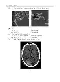 神经影像学：核心复习