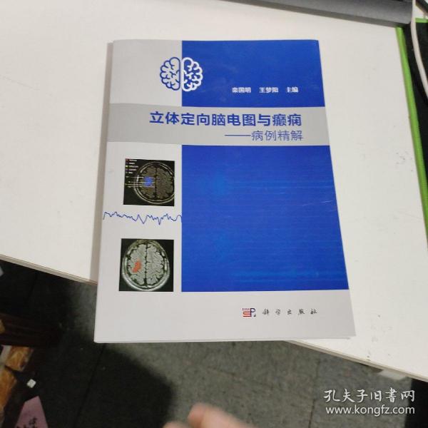 立体定向脑电图与癫痫——病例精解