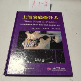 上颌窦底提升术