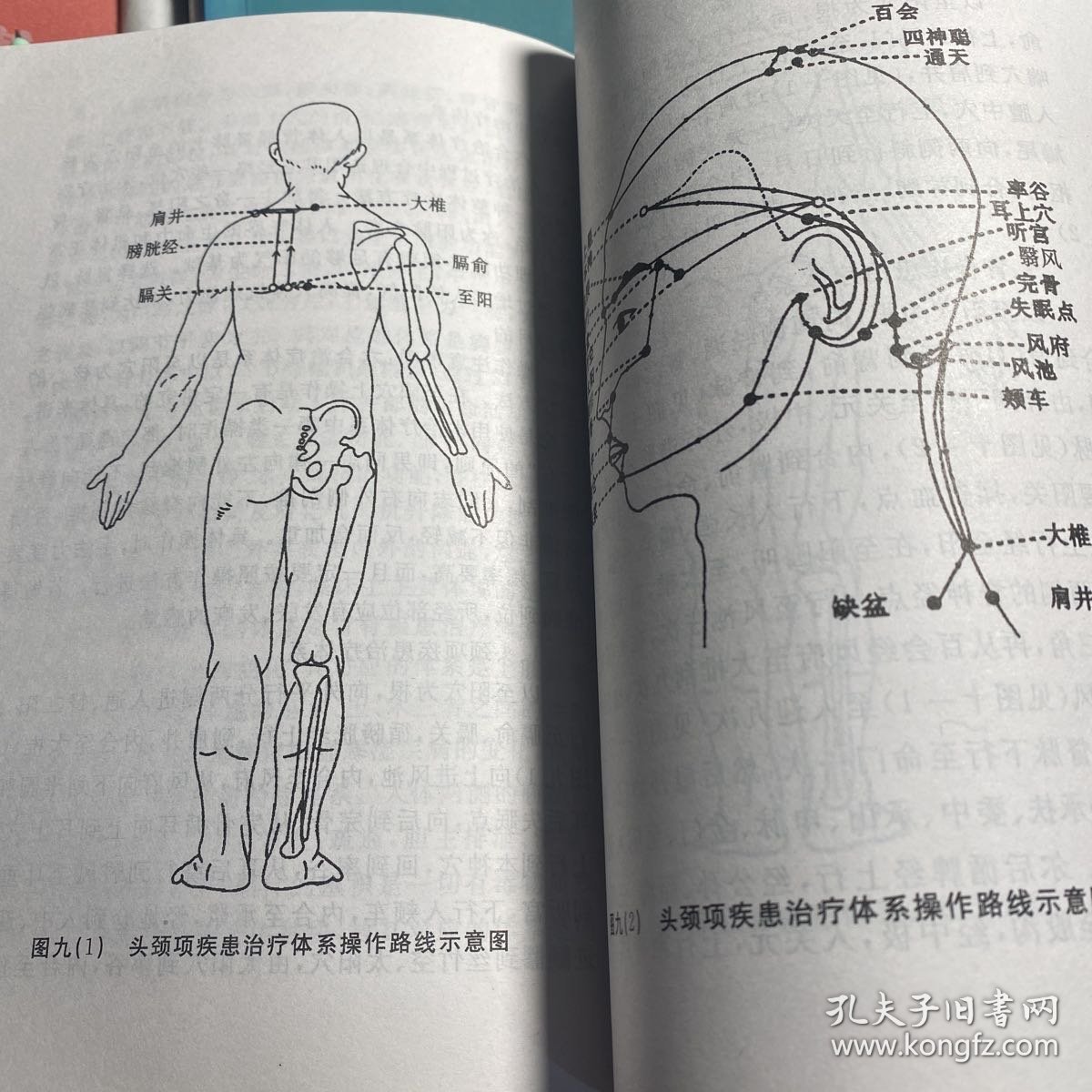 杨氏四合一从根论治糖尿病专辑