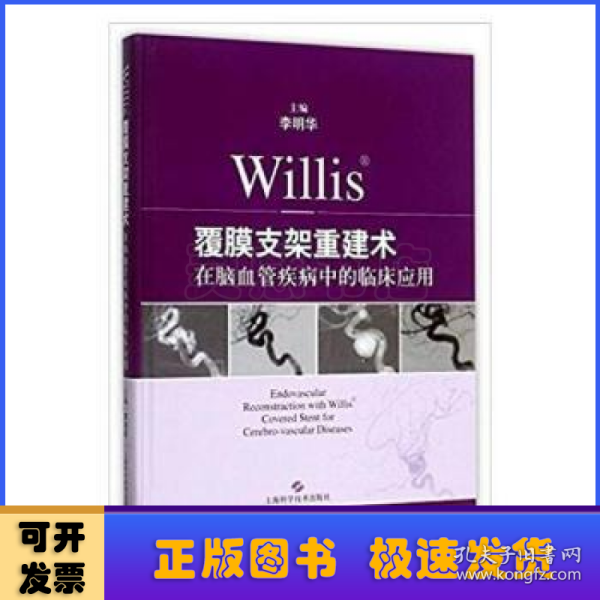 Willis覆膜支架重建术在脑血管疾病中的临床应用