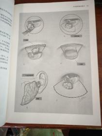 实用耳鼻咽喉手术图谱（精装本）