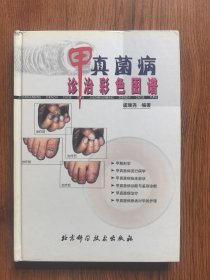 甲真菌病诊治彩色图谱