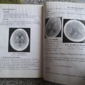 颅脑CT比较诊断与鉴别诊断学