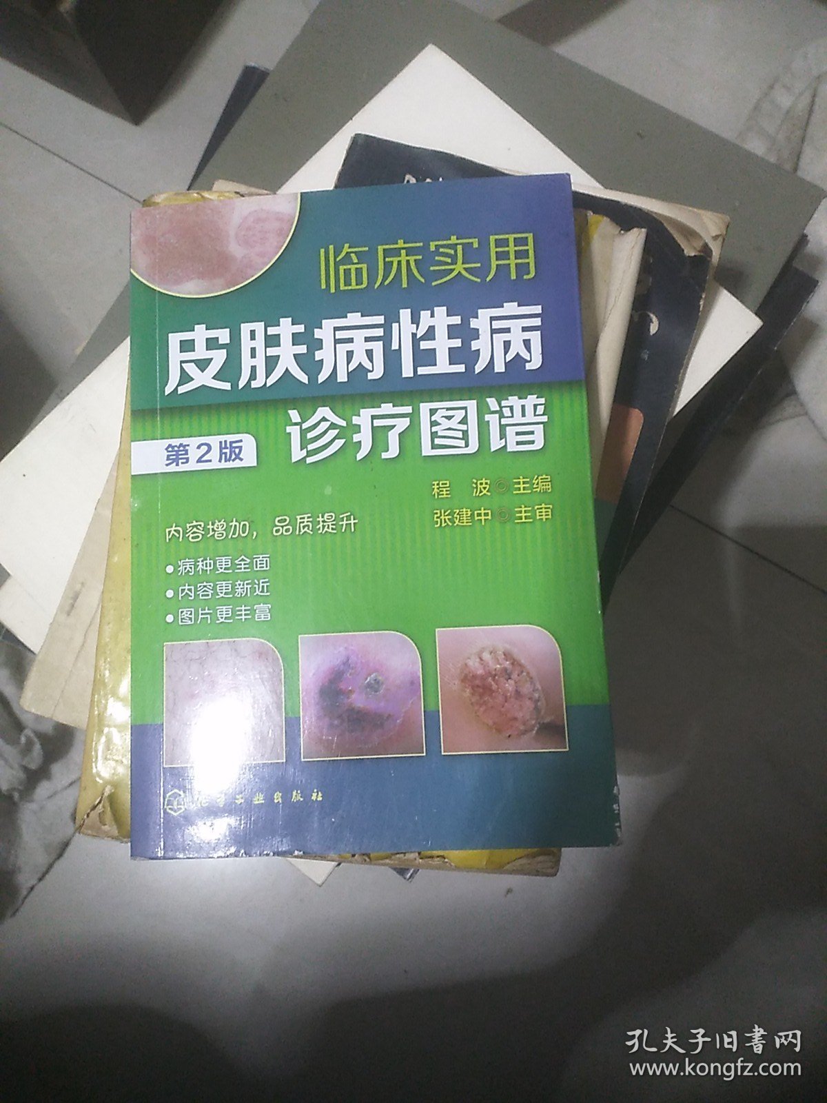 临床实用皮肤病性病诊疗图谱（第2版）