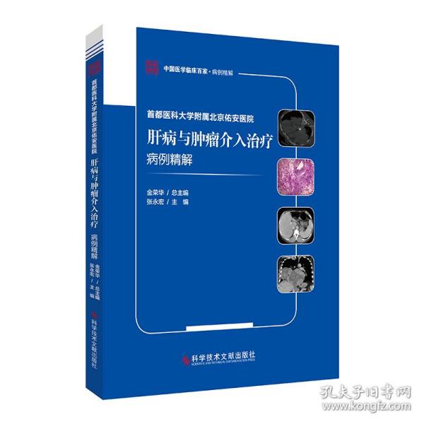 首都医科大学附属北京佑安医院肝病与肿瘤介入治疗病例精解